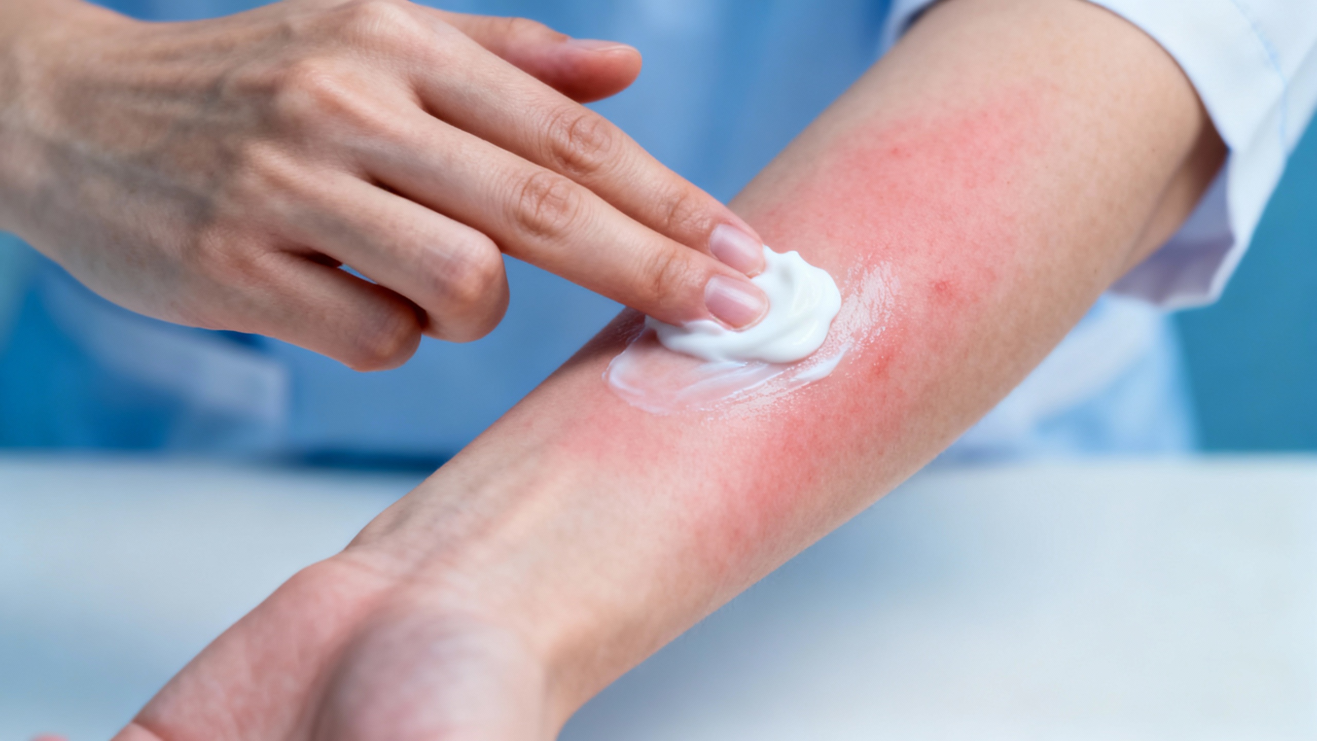 Featured image for Stop the Itch: Powerful Remedies for Contact Dermatitis Relief