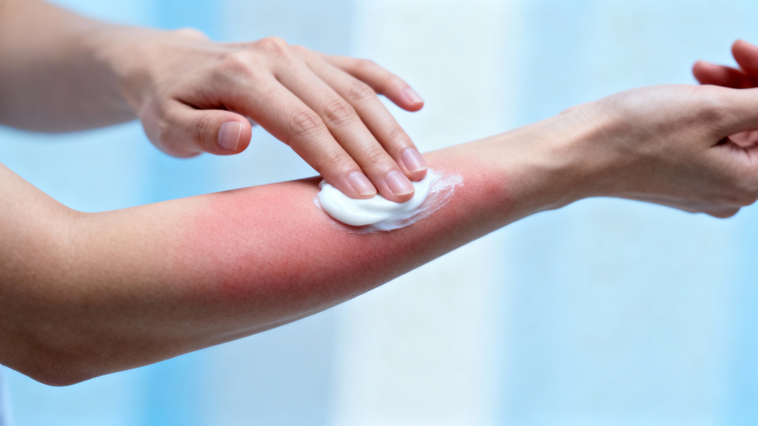 Featured image for Say Goodbye to Irritation: How to Soothe Contact Dermatitis